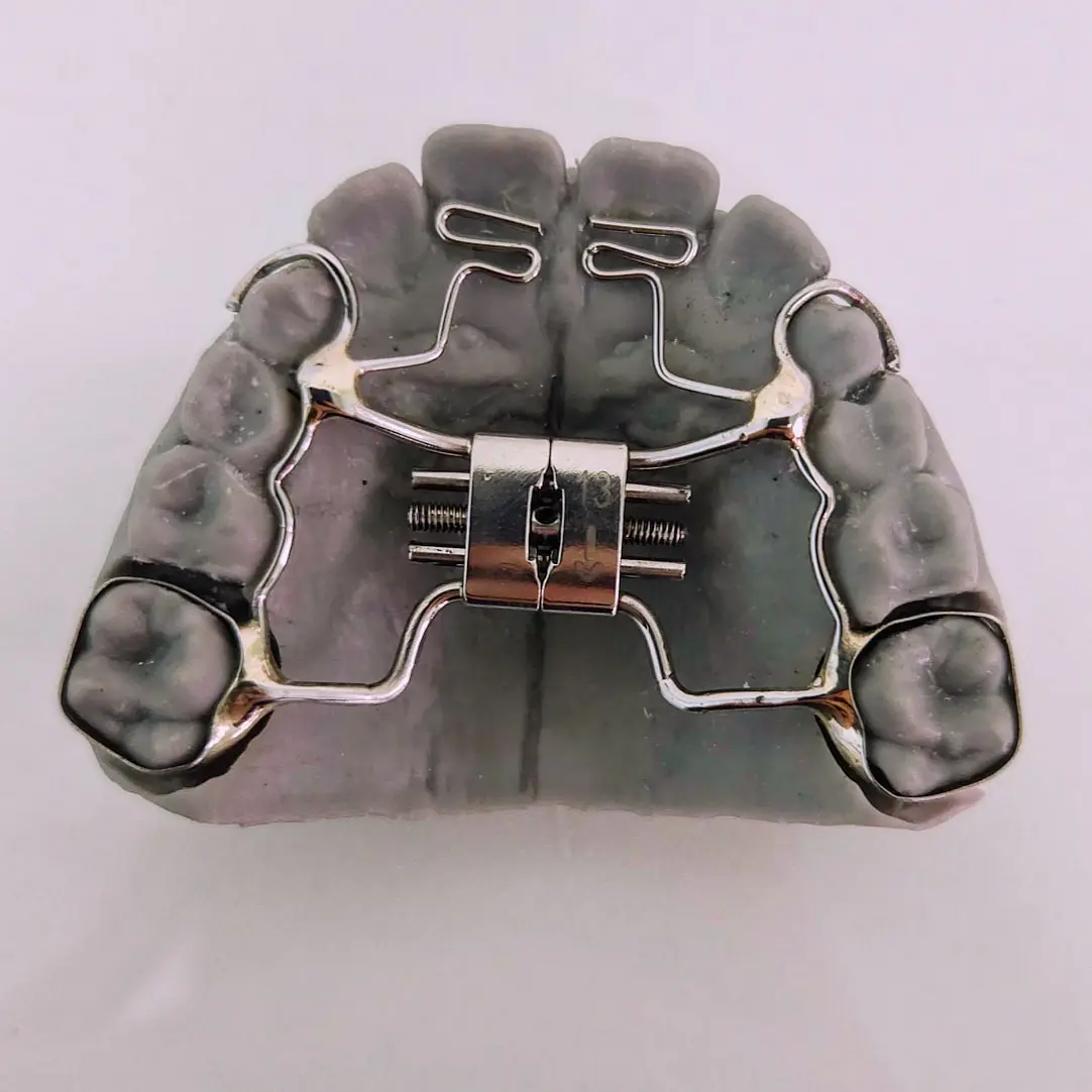 Alinhadores ortodônticos - Clivive Odontologia