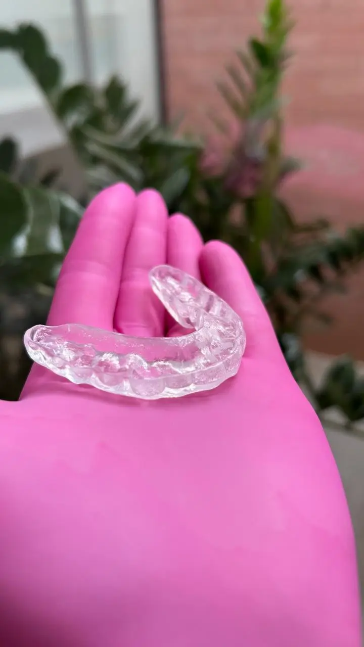 Placa miorrelaxante (bruxismo) - Clivive Odontologia